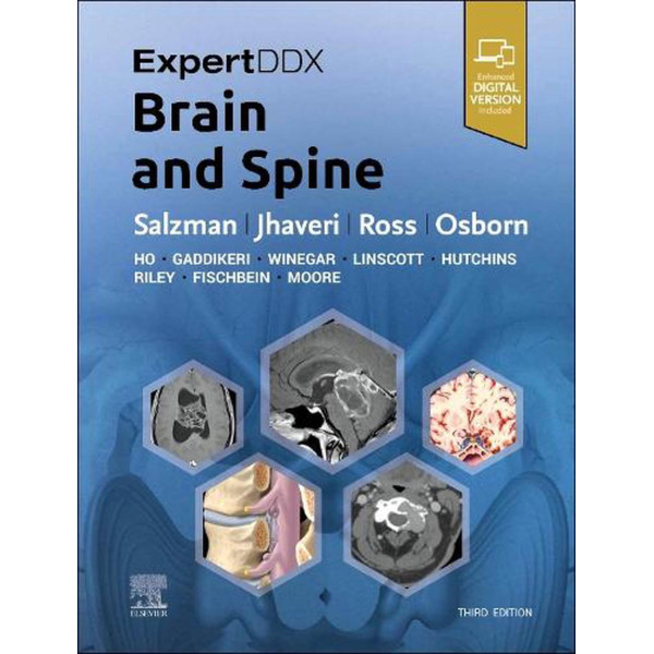 ExpertDDx: Brain and Spine, 3rd Edition Νευρολογία
